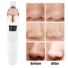 New 5-in-1 Electric Blackhead Remover Machine (Original)